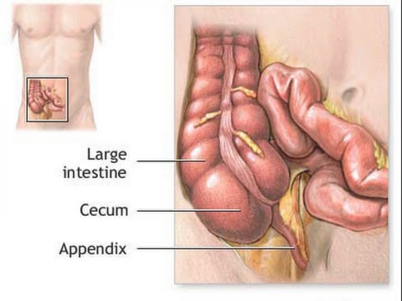 What Side Is Your Appendix On Symptoms Of Appendicitis Treatment